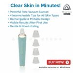 Blueidea Blackhead Remover | Deep Pore Cleaning | Clear & Smooth Skin - Image 4